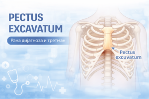 Анатомска илустрација на Pectus excavatum – вдлабнат граден кош