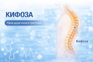 Анатомска илустрација на кифоза со нагласена кривина на торакалниот дел од ‘рбетот