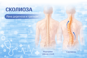 Анатомска илустрација на сколиоза со странична кривина на ‘рбетниот столб